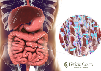 Imagem ilustrativa de microbiota intestinal saudável e disbiose, com destaque para o desequilíbrio de bactérias no intestino.