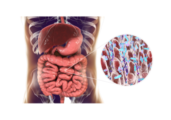 Imagem ilustrativa de microbiota intestinal saudável e disbiose, com destaque para o desequilíbrio de bactérias no intestino.