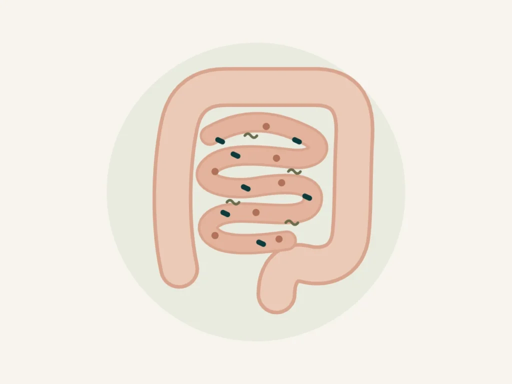 Ilustração do intestino com diferentes bactérias representando disbiose intestinal