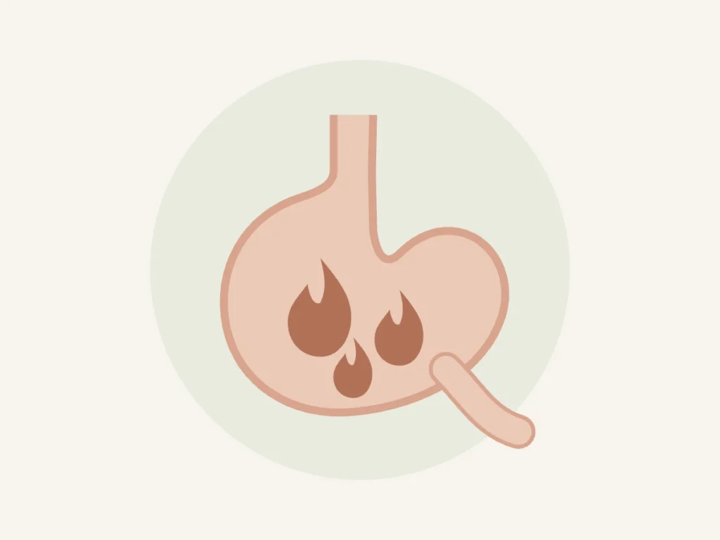 Ilustração do estômago inflamado representando gastrite