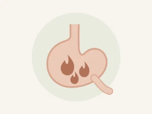 Ilustração do estômago inflamado representando gastrite