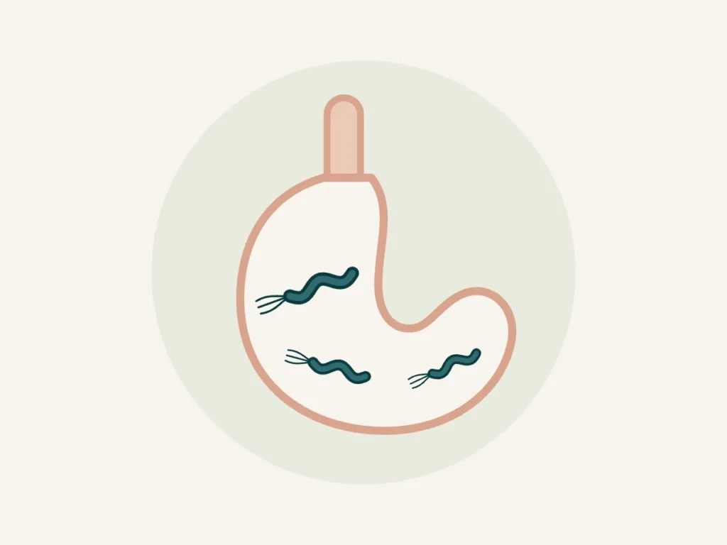 H. pylori: o que é, sintomas, exames e tratamento