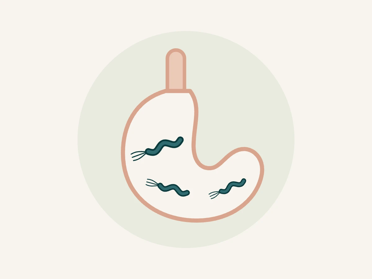 Ilustração do estômago com bactérias H. pylori em forma de espiral