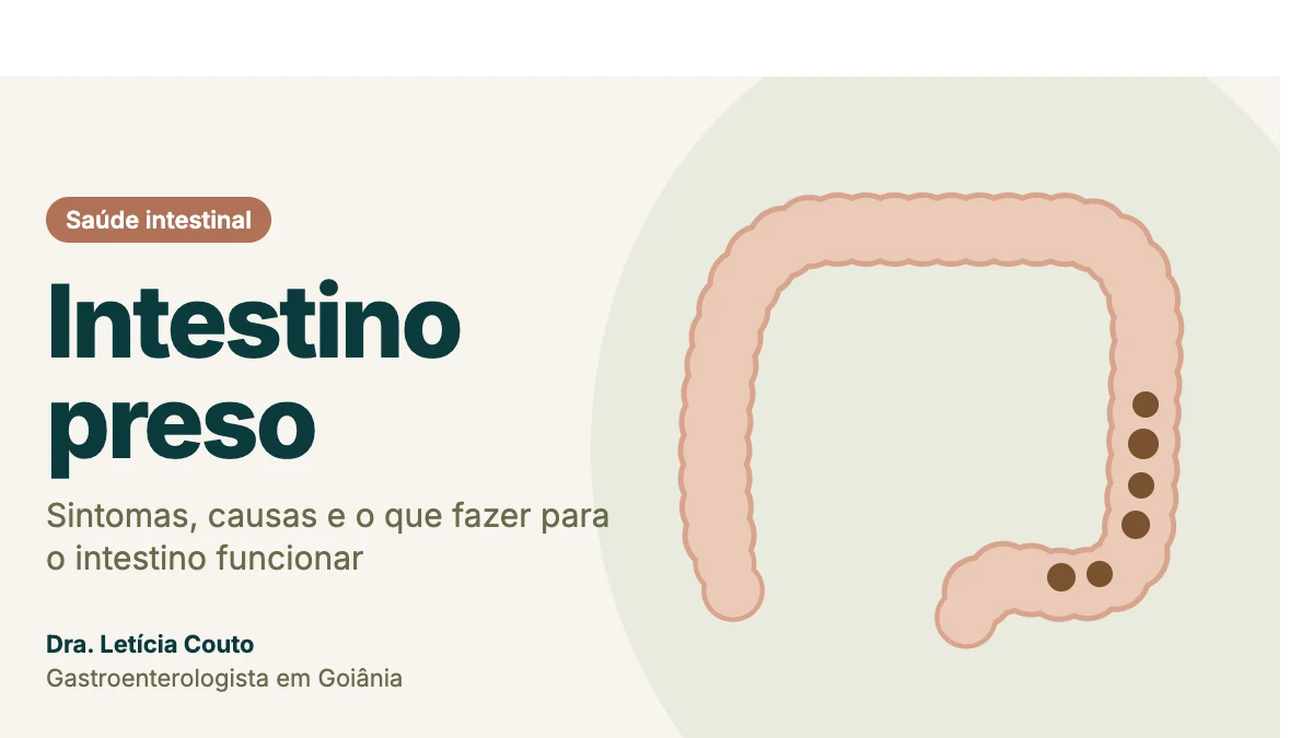 Ilustração do intestino grosso com fezes endurecidas, representando o intestino preso