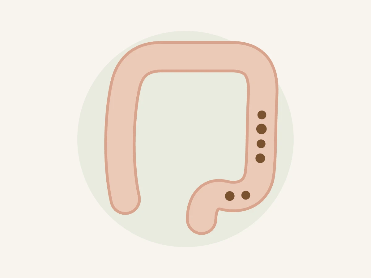 Ilustração do intestino grosso com fezes retidas representando intestino preso