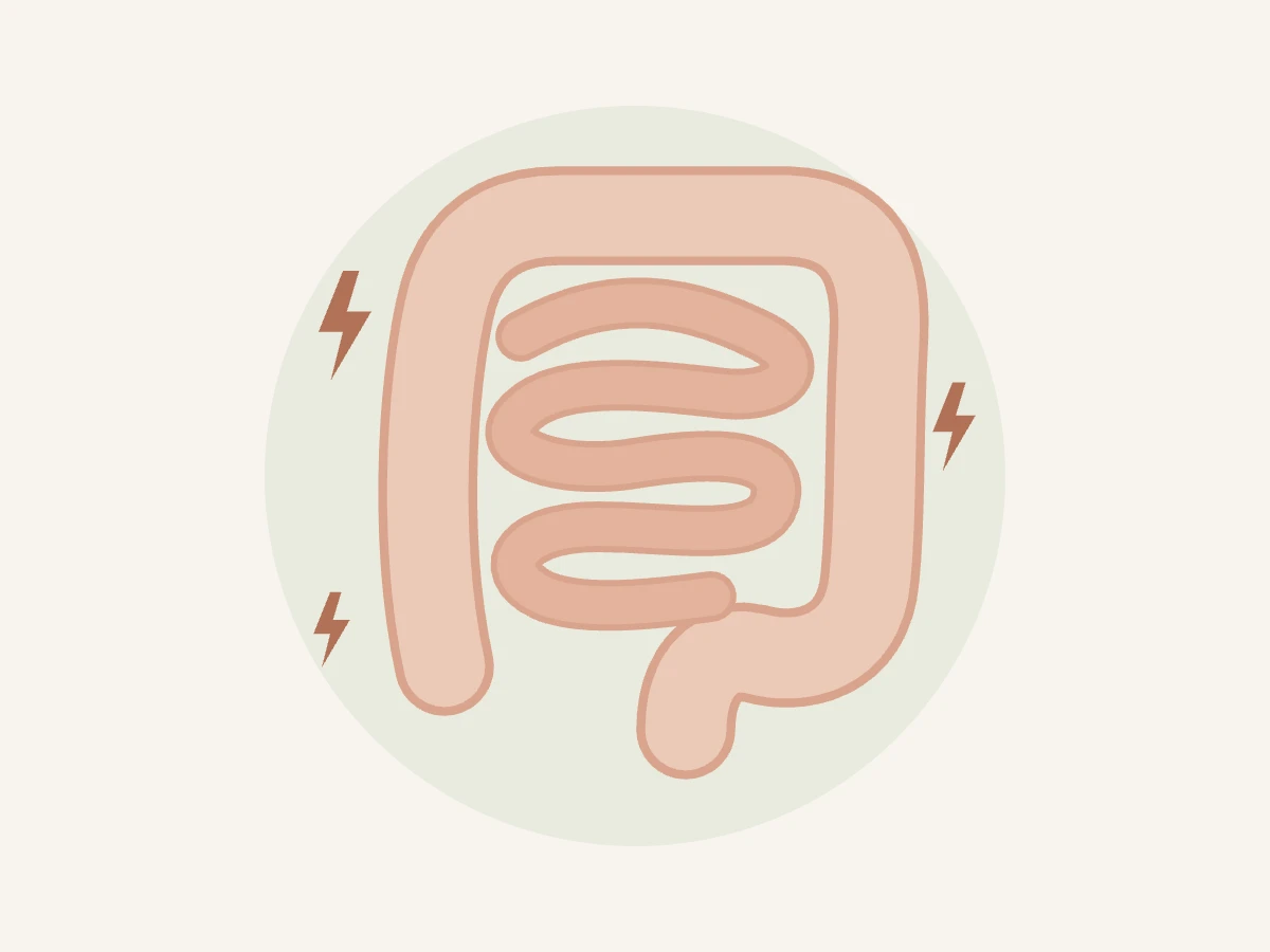 Ilustração do intestino com sinais de dor representando a síndrome do intestino irritável